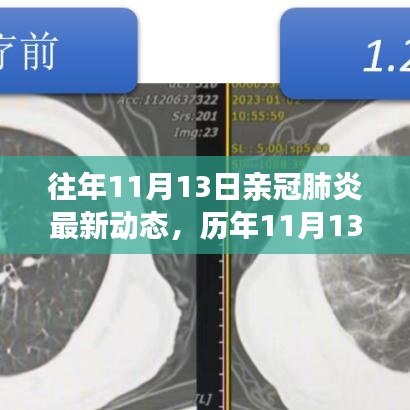 歷年11月13日新冠肺炎動(dòng)態(tài)回顧，最新進(jìn)展、當(dāng)前動(dòng)態(tài)與未來(lái)展望