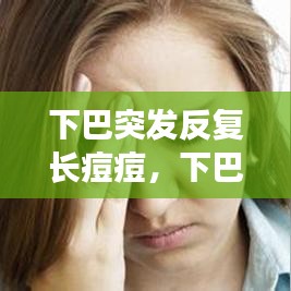 下巴突發(fā)反復(fù)長(zhǎng)痘痘，下巴突發(fā)性長(zhǎng)痘 