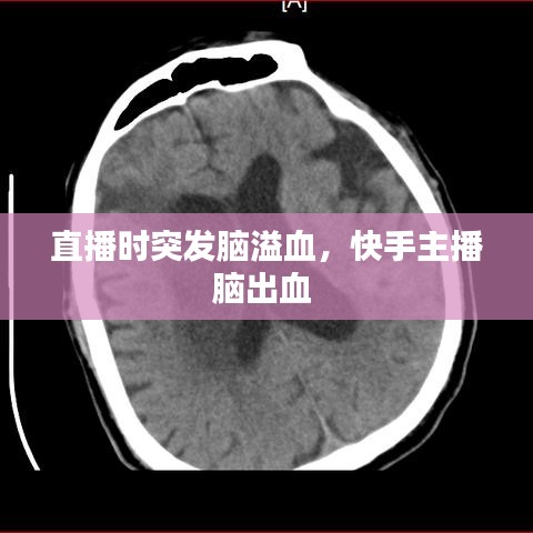 直播時(shí)突發(fā)腦溢血，快手主播腦出血 