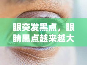 眼突發(fā)黑點(diǎn)，眼睛黑點(diǎn)越來越大 